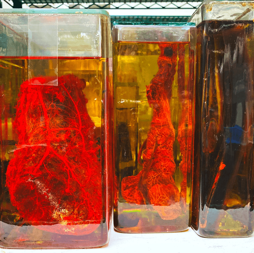 Glass jars with red wet specimens preserved in fluid