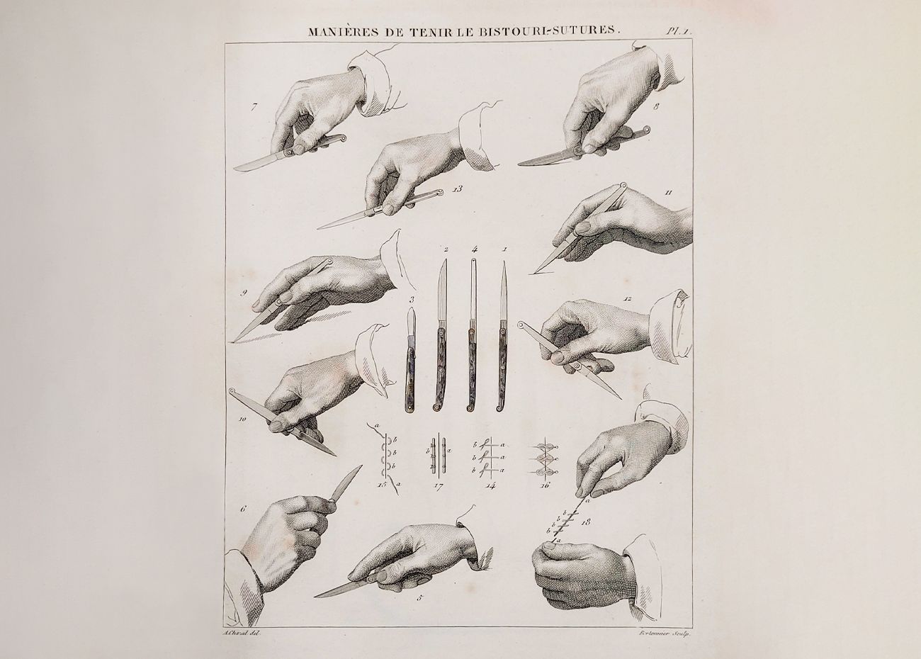 Medical illustration of hands holding scalpels in different positions