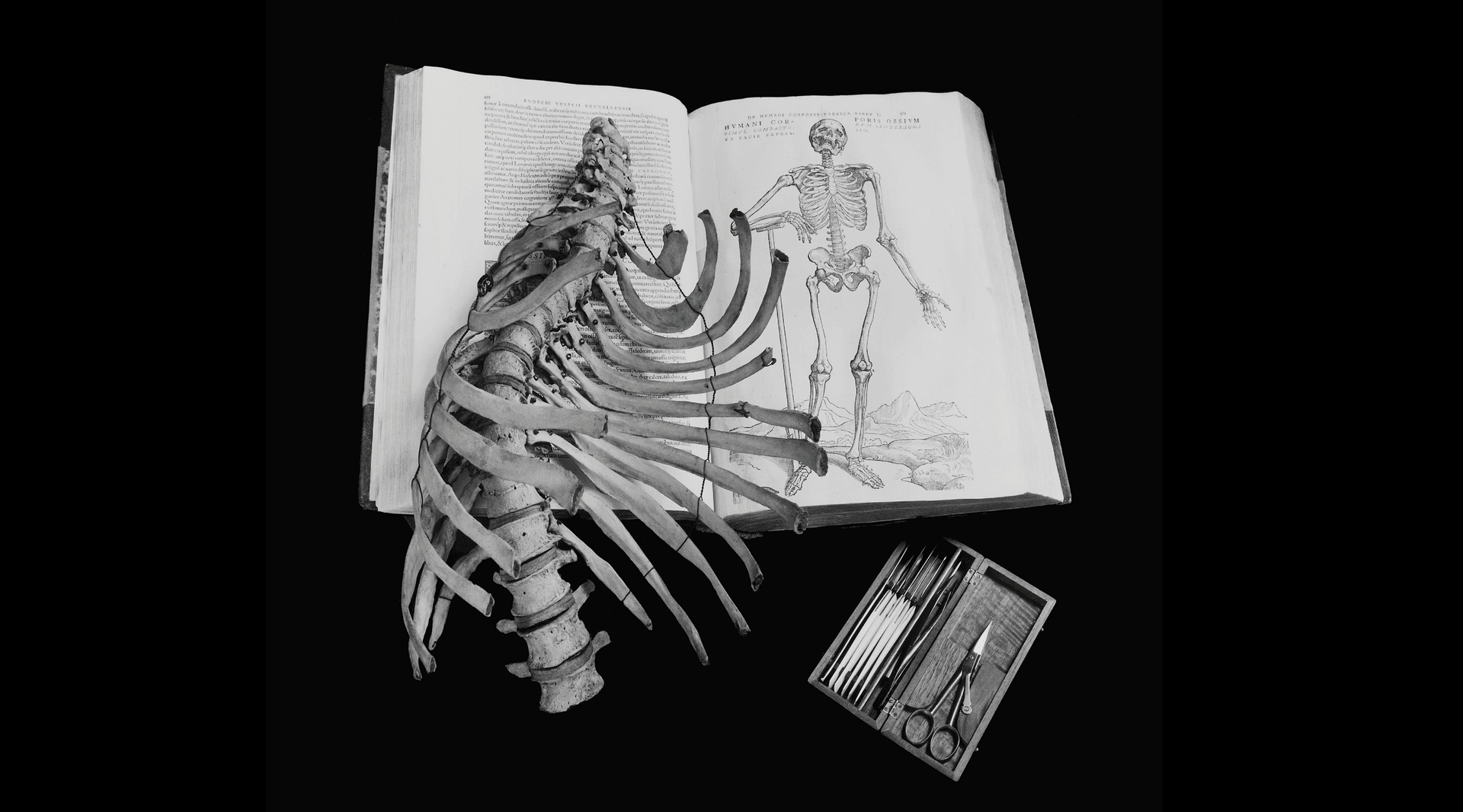 Black and white photograph of skeletal specimen laying across anatomical book with medical tools below