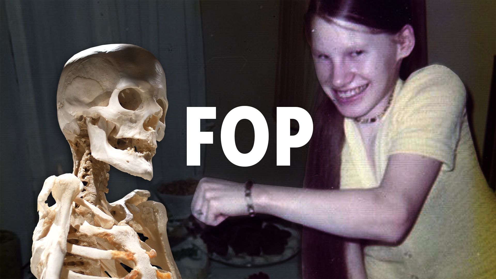 Fop Skeleton