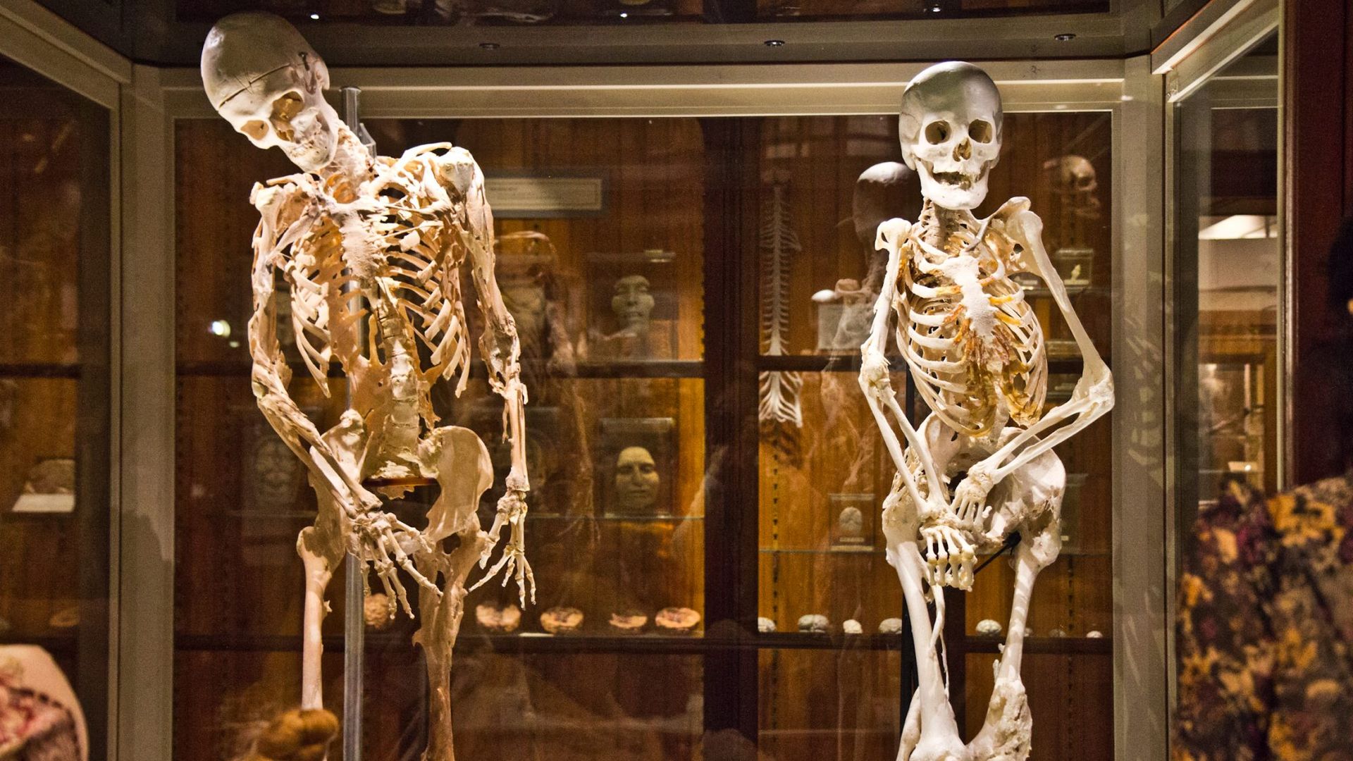 Two skeletons positioned side by side in a glass case