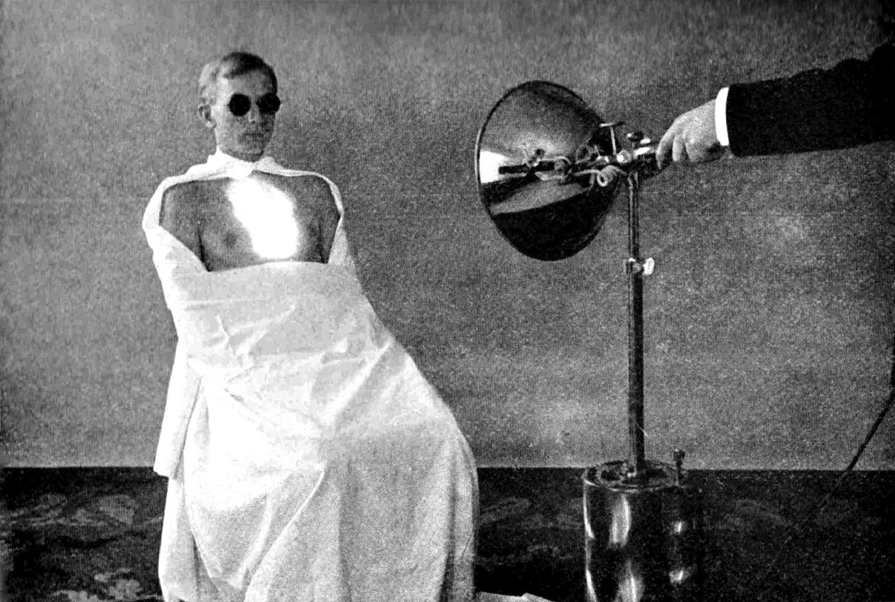 A patient wearing sunglasses while seated in front of a bright lamp
