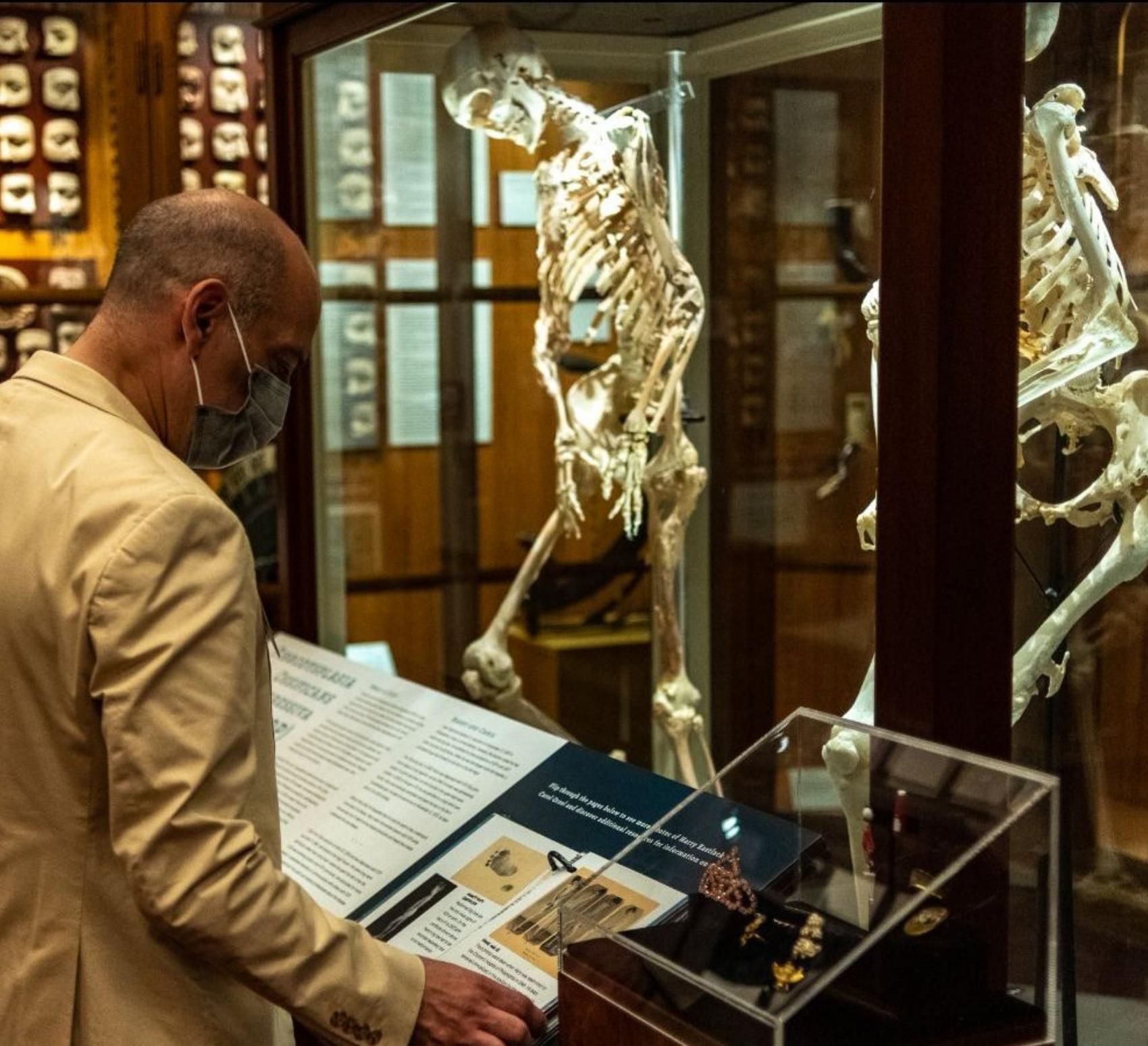 World'S Largest Pimple? Mutter Museum Holds The Key - 8i85hgr