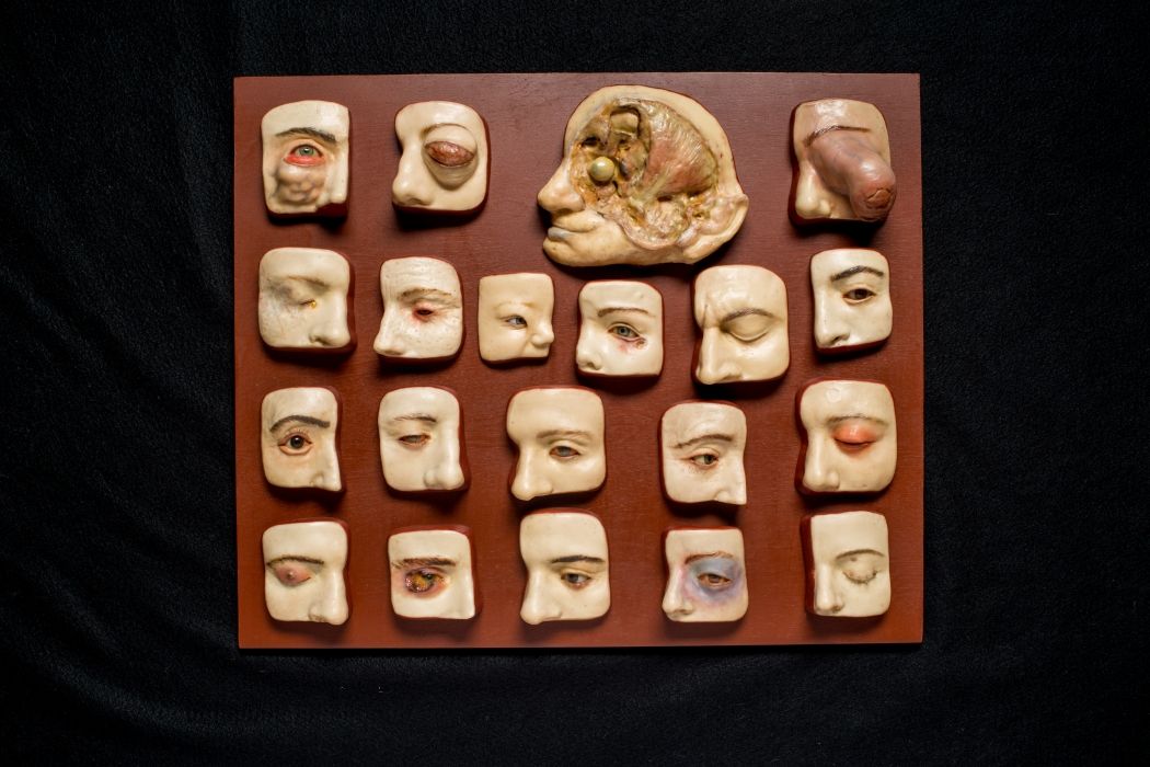 Realistic collection of 20 different eye diseases and conditions in modeled wax