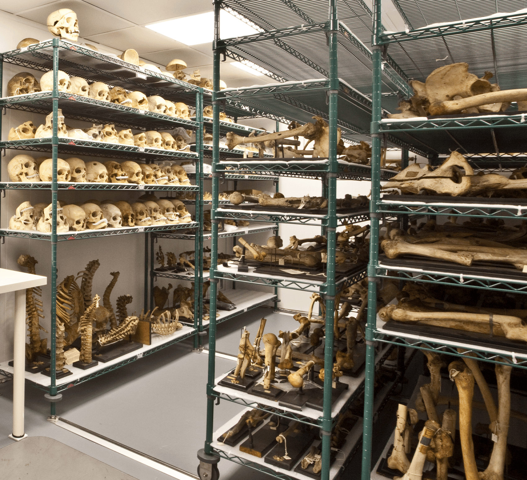 World'S Largest Pimple? Mutter Museum Holds The Key - lfjz76y