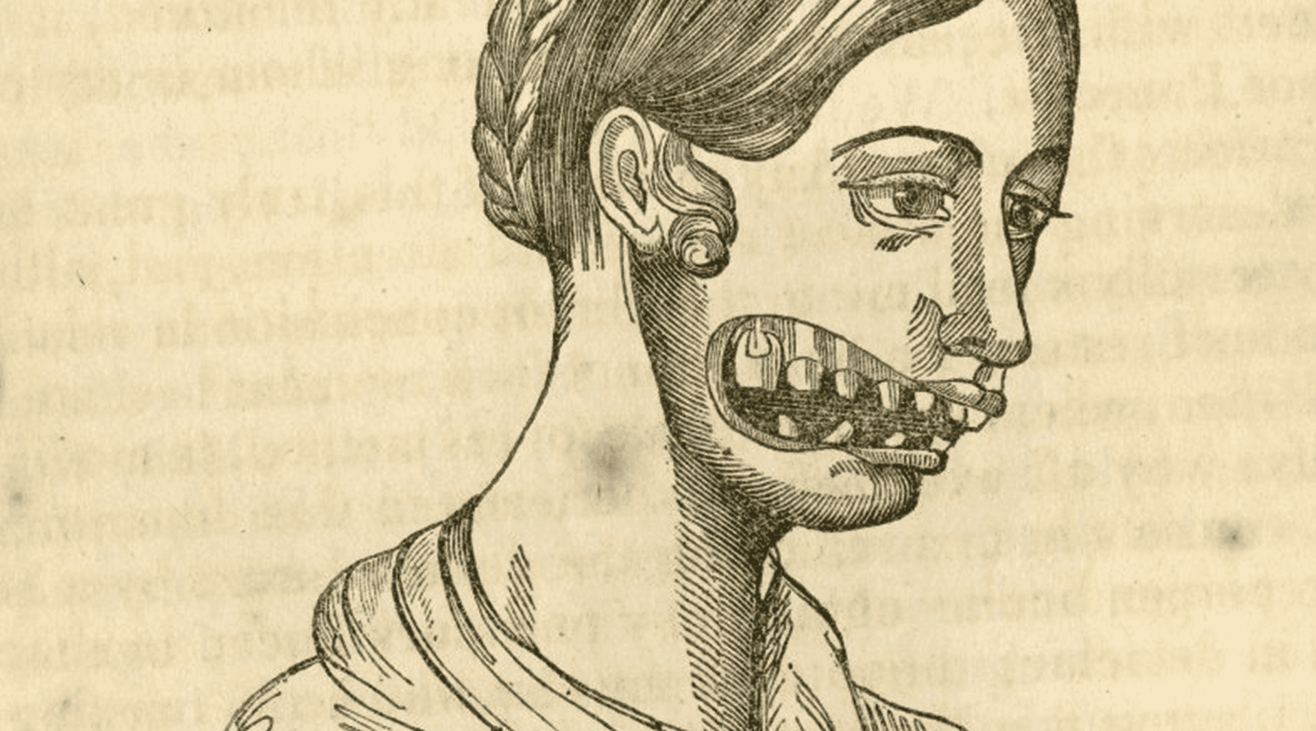 Illustration of woman with facial skin damaged and revealing broken teeth