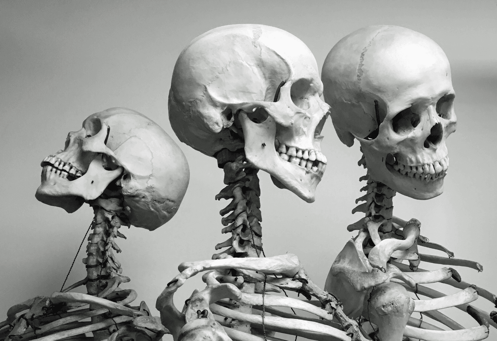 Three skeletons in a row